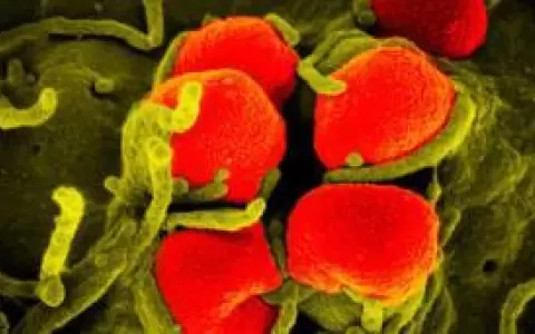 Gonorrea resistente a los medicamentos se expande en China, lo que representa una amenaza global