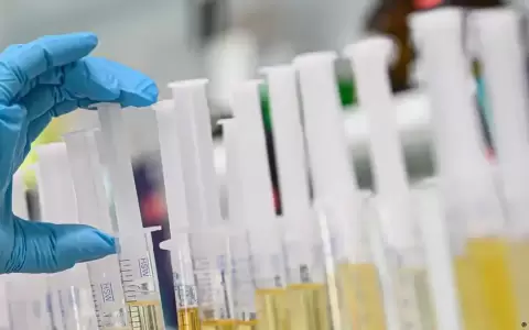 Chile: orina humana como alternativa para crear fertilizante