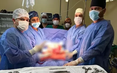 Extirparon tumor de 3 kilos de una mujer en el Chaco