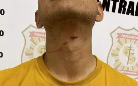 Polic�a Bolt que dispar� a supuesto asaltante afirm� que lo agarraron del cuello