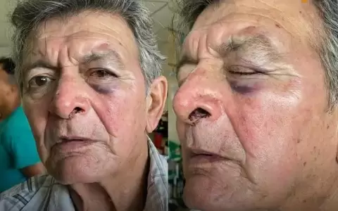 Taxista anciano fue brutalmente agredido por motociclista, buscan al responsable