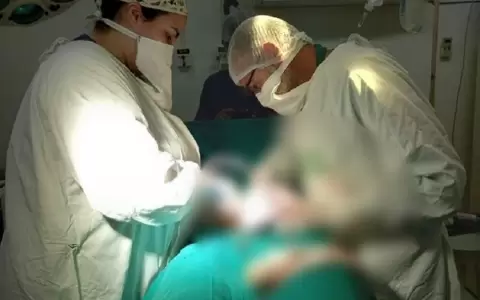 Extirpan tumor de 5 kilos en el Hospital Distrital de Santa Rosa