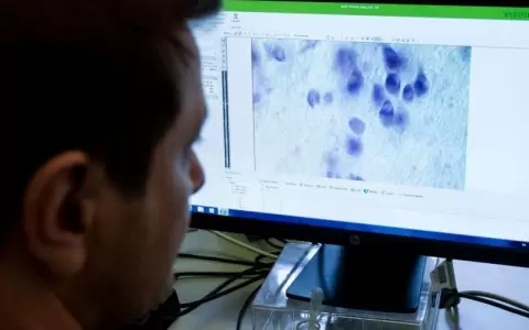 Hoy es D�a Mundial del Cerebro y profesionales brindan consejos para cuidarlo