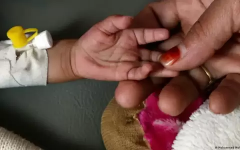 ONU: unas 26 millones de personas sufren "hambre aguda" y 750 mil "a un paso de la hambruna"