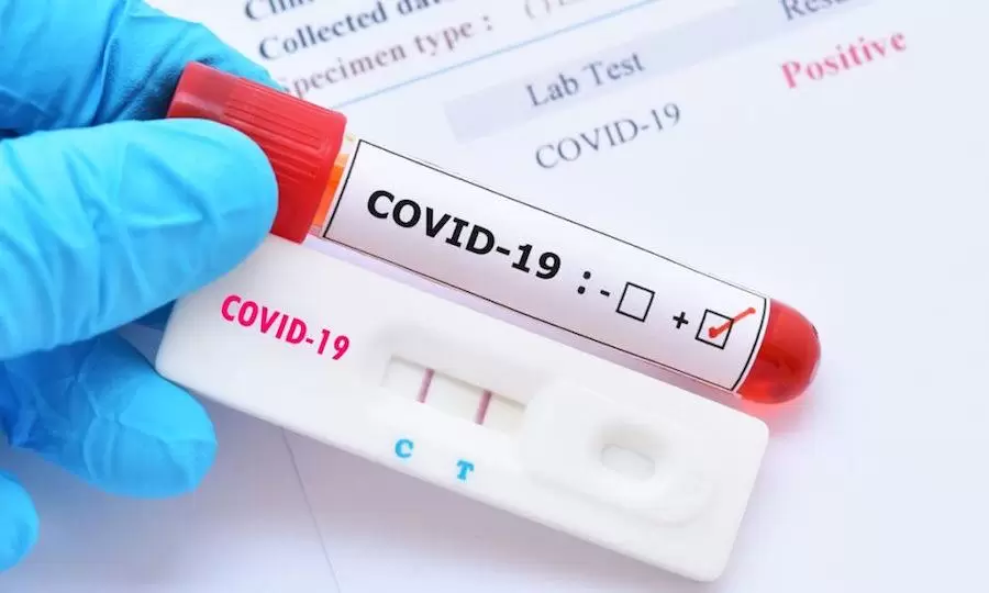 OMS: Covid-19 causa 1.700 muertes a la semana en el mundo