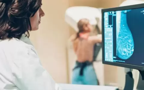 M�s prevenci�n y menos burocracia: mujeres podr�n hacerse mamograf�a sin orden m�dica
