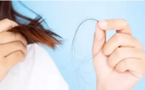 Ca�da del pelo: cu�nta p�rdida de cabello es normal en las mujeres