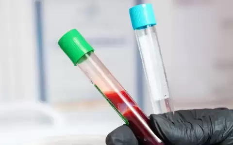Detecci�n del Alzheimer con an�lisis de sangre: datos clave