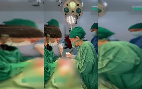 Extirparon tumor gigante del ovario a una mujer, el bulto ten�a 19 kilos