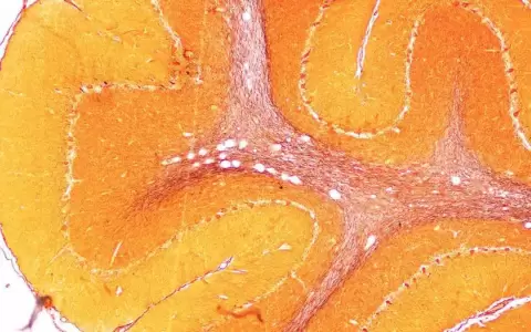 Cient�ficos buscan rejuvenecer cerebros con tejido cultivado