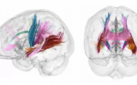 �Qu� sucede en el cerebro de una mujer embarazada?