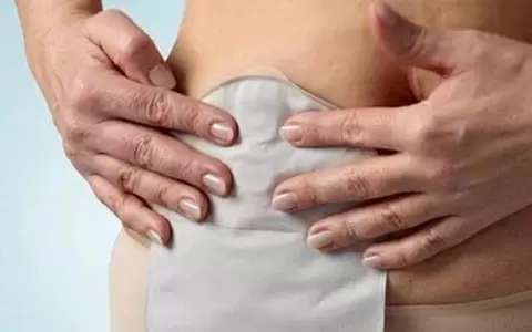 �La bolsa es vida�: Salud conmemora el D�a Nacional del Paciente Ostomizado