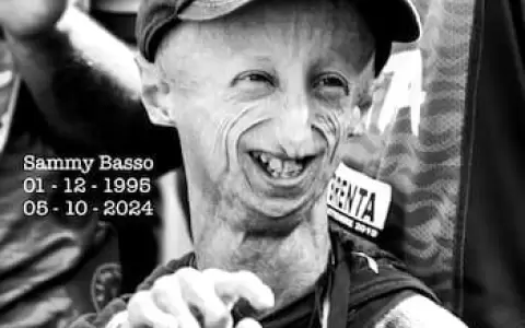 Muri� Sammy Basso, el italiano que visibiliz� el s�ndrome de progeria que lo envejec�a prematuramente