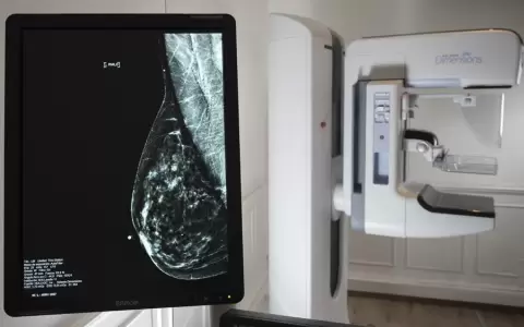 Octubre Rosa: estos son los mam�grafos disponibles en Salud P�blica
