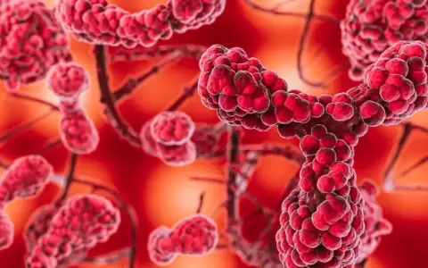 Caso estudiante de Capiat�: �Qu� es el streptococcus pyogenes y cu�ndo podr�a ser grave?