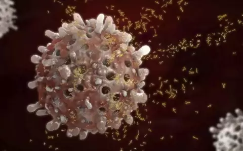 Detecci�n de ADN tumoral en sangre tras el tratamiento prequir�rgico anticipa reca�das en c�ncer de mama