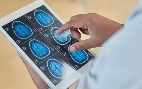 Ecuador realiza por primera vez cirug�a craneal con IA