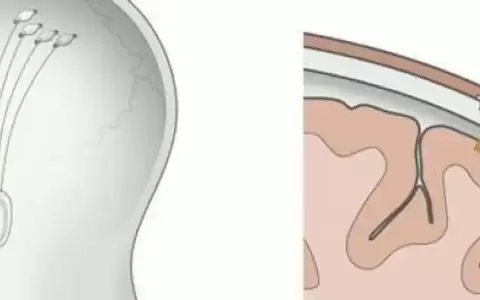 Neuralink probar� chip cerebral para mover brazos rob�ticos