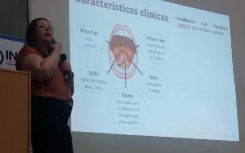 Hoy se recuerda el D�a Latinoamericano de Prevenci�n del C�ncer Bucal