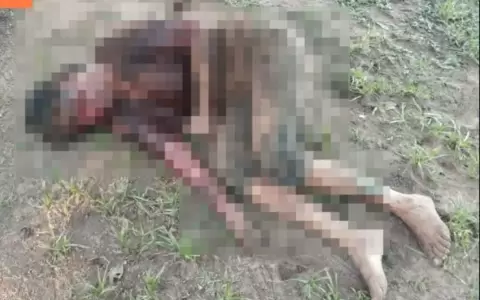 Mujer atacada por pitbull tras ingresar a granja fue amputada de ambos brazos