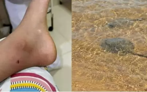 Rayas en playa San Jos� de Encarnaci�n: menores que fueron atacados se encuentran en buen estado