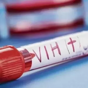 El VIH caus� 1,2 millones de nuevos casos en el mundo en 2025, un 43% menos que en 2010