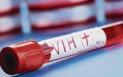 D�a Mundial del VIH.