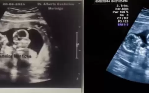 Investigan supuesta desaparici�n de gemelos, presumen que mujer habr�a fingido embarazo