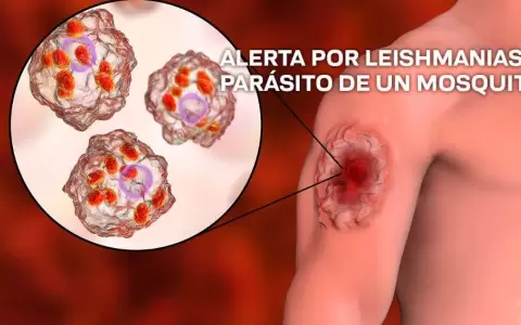 D�a Mundial de las Enfermedades Tropicales: se report� un centenar de casos de leishmaniasis
