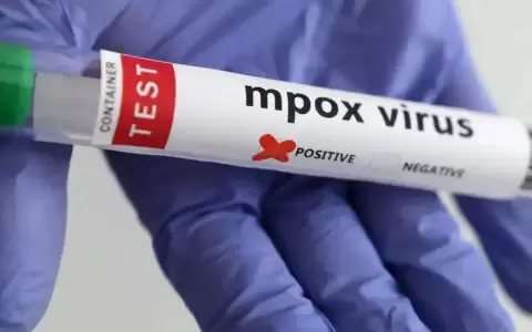 OMS mantiene emergencia internacional por mpox