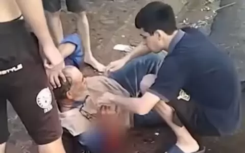 Hombre de 65 a�os fue atacado por dos perros pitbulls en la v�a p�blica
