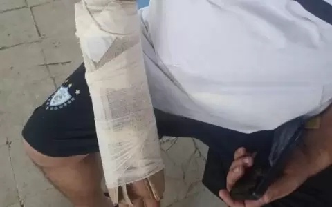 IPS "agradece" 15 a�os de aporte poniendo cart�n a la fractura de un asegurado