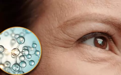 Sin arrugas a los 60: tres vitaminas que debes usar para eliminar l�neas de expresi�n