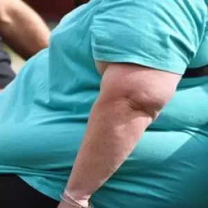 El 64% atribuye la obesidad a decisiones personales