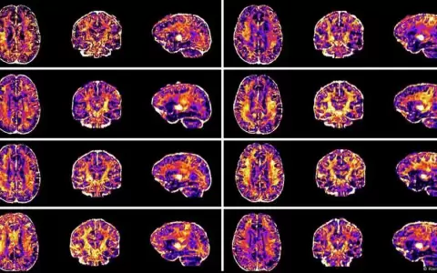 Tu cerebro se consume a s� mismo durante ejercicio intenso