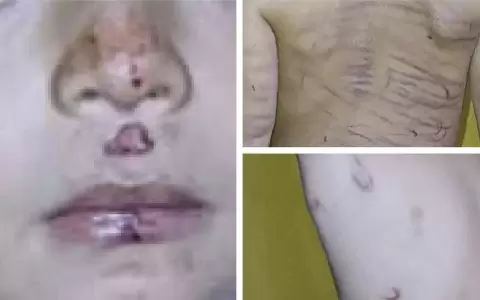 Ni�o de 3 a�os fue brutalmente golpeado por su padrastro con un cinto y un cable