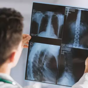 Denuncia de saturaci�n laboral en la carrera de Radiolog�a