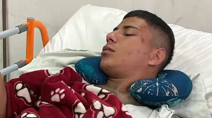 El joven se encuentra bajos observaci�n en el Hospital del Trauma.