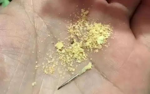 Aguja encontrada en el paquete de chipita que se le entreg� al alumno.