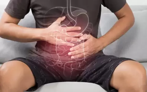 La colitis ulcerosa es una enfermedad cr�nica que puede aliviarse moment�neamente, pero puede regresar de forma intensa en cualquier momento.