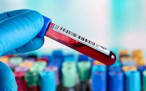 Pacientes con leucemia mieloide aguda logran remisi�n total usando terapia con c�lulas CAR NK.