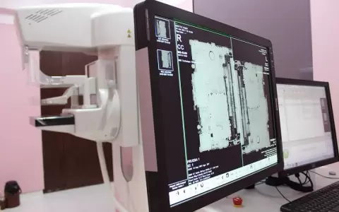 Equipo de mamograf�a del Ministerio de Salud.