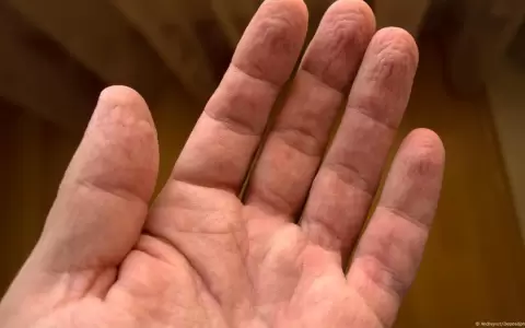 El profesor Guy German demostr� que las arrugas de los dedos siguen patrones �nicos que se repiten con asombrosa precisi�n en cada inmersi�n.