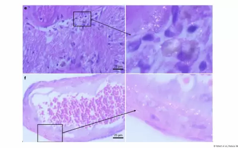 Imagen ilustra un estudio que demuestra que diminutas part�culas de pl�stico pueden acumularse en el cerebro humano que en el ri��n y el h�gado.