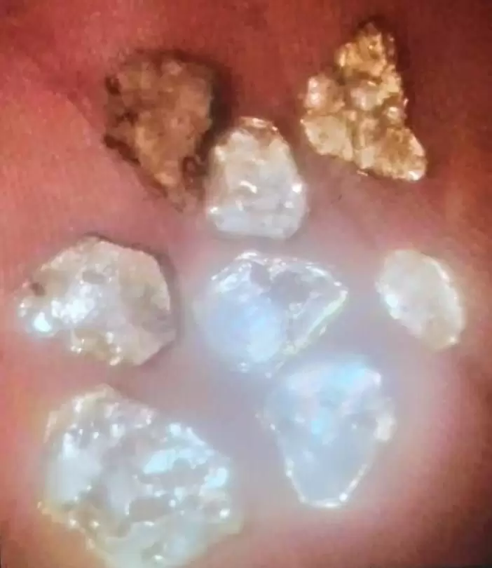 Parte de lo que se habr�a encontrado tras las excavaciones.