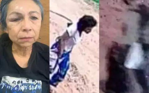 Estela Galeano qued� con el rostro desfigurado. Los malvivientes ser�an supuestos recicladores.