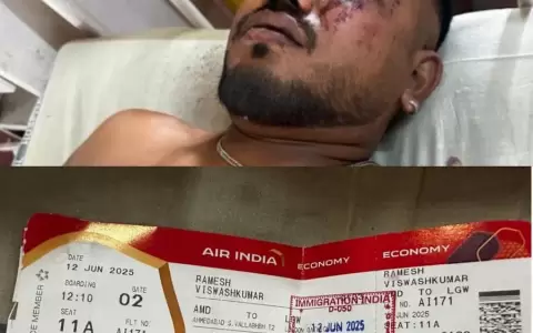 Vishwash Kumar Ramesh, �nico sobreviviente del Air India siniestrado.