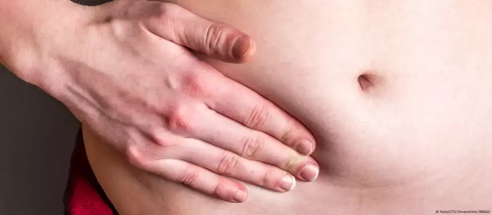 El cáncer de apéndice es uno de los tipos de cáncer más raros, pero la incidencia ha aumentado drásticamente entre jóvenes. Foto:Natali270/Dreamstime/