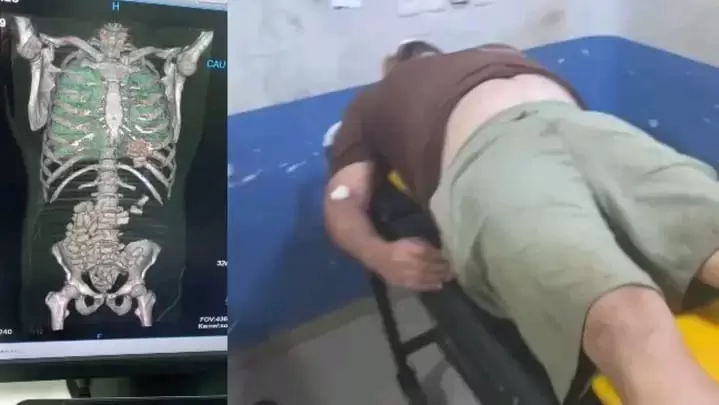 Abrahan Santiago V�zquez Melgarejo , se encuentra en delicado estado de salud.