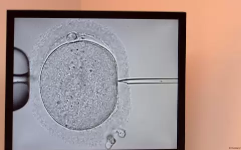 La t�cnica de reproducci�n asistida avanzada abre discusiones �ticas y cient�ficas.